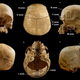 Multiple view of the cranium.